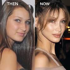 The Rise and Influence of Bella Hadid in Fashion