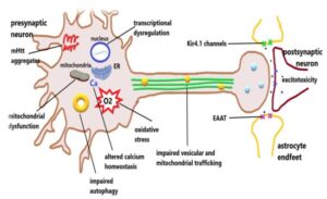 Revolutionary Advances in Huntington Disease Gene Therapy
