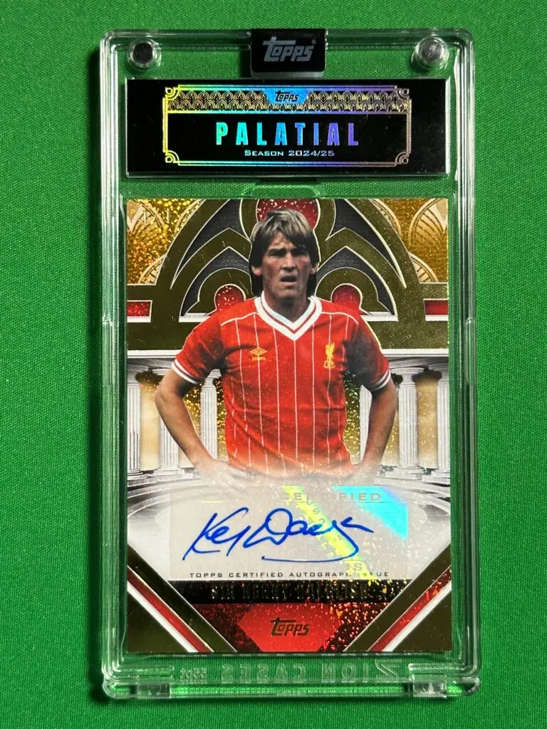 Kenny Dalglish: The Impact of a Liverpool Football Legend