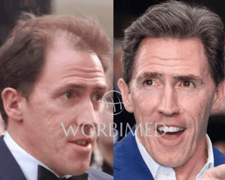 Rob Brydon: The Journey of a British Comedy Icon